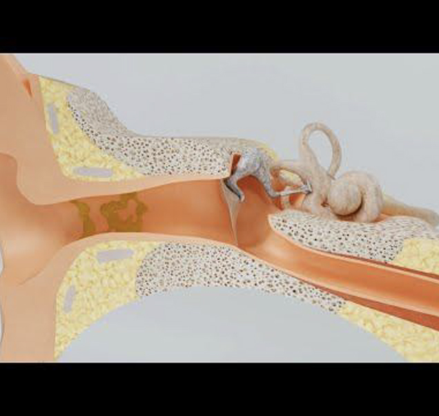 JDA | Introduction to Ear Wax Module