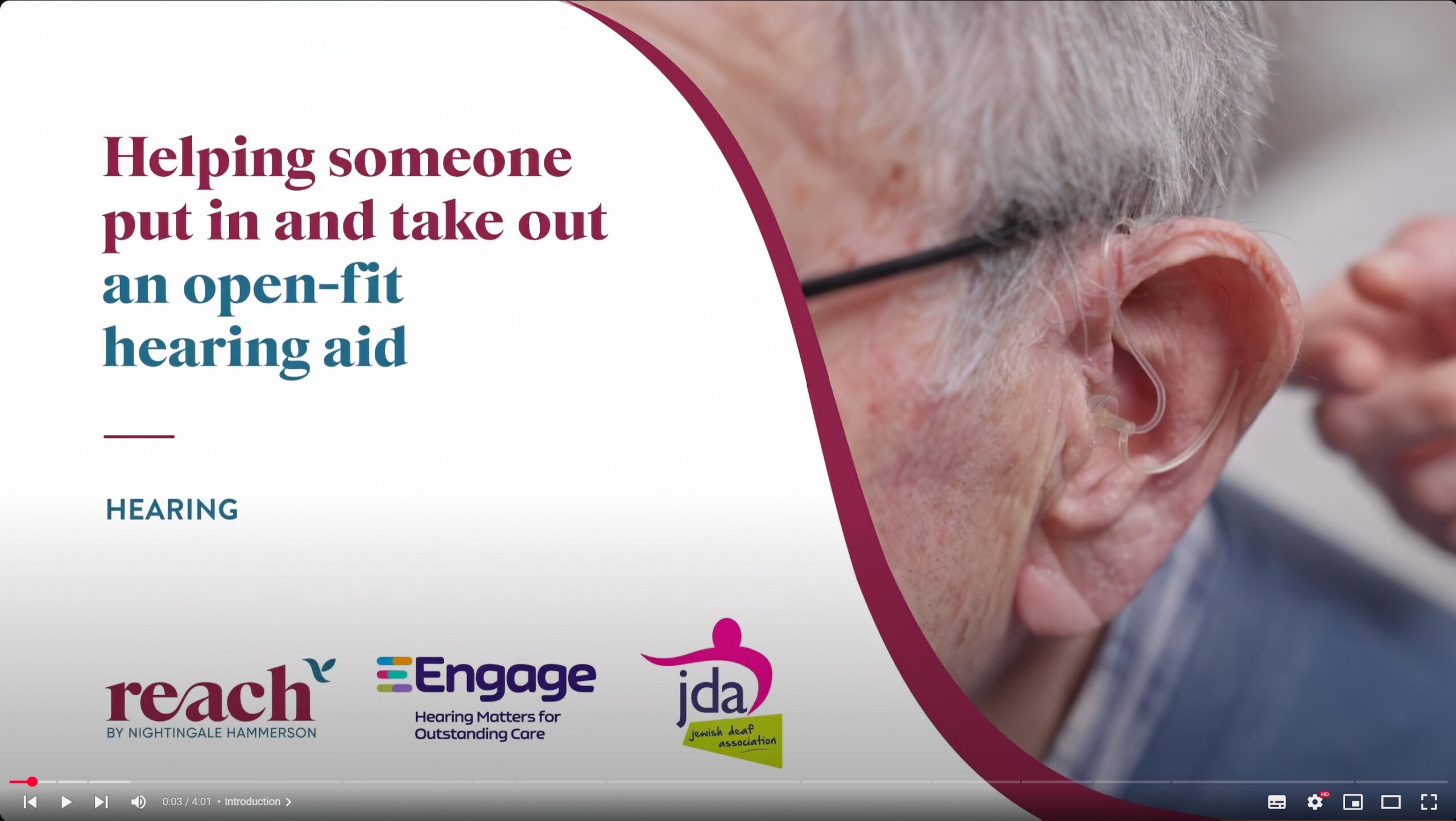 How to Assist with Inserting & Removing a Hearing Aid (Open Fit Dome Guide)